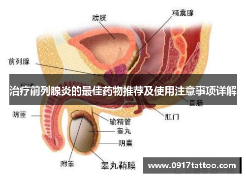 治疗前列腺炎的最佳药物推荐及使用注意事项详解